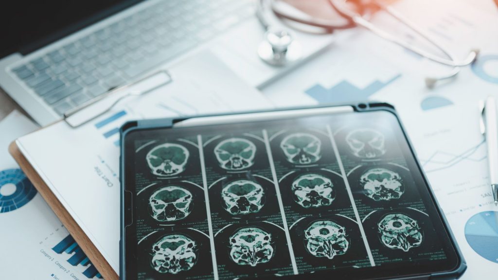 Study finds ‘regional differences’ in dementia rates among veterans