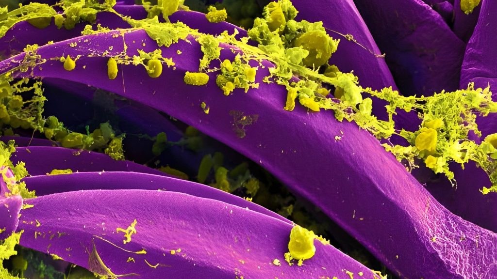Arizona patient dies of bubonic plague in emergency room: Report