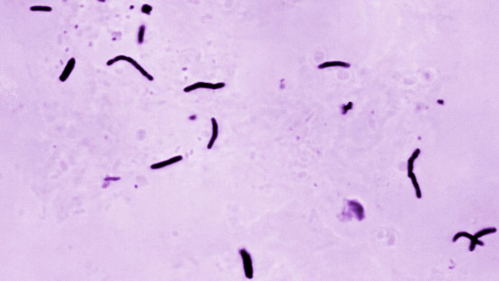 TB is spreading in ICE detention centers. So what’s the agency’s responsibility?