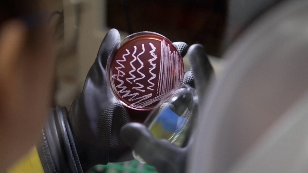 At-home gut microbiome tests grow in popularity, but experts say they’re limited