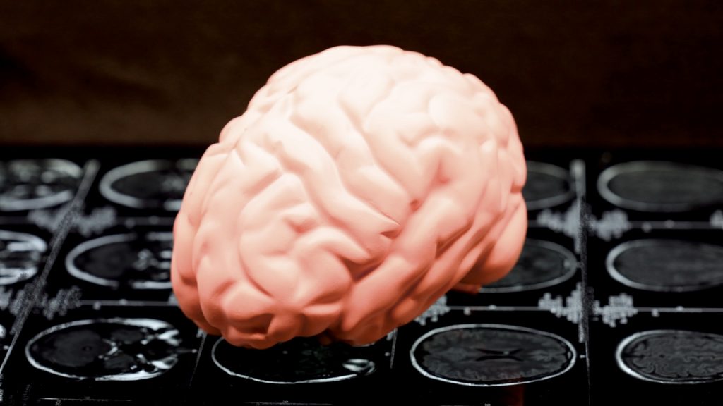 Study says DNA damage seen in Alzheimer’s also linked to CTE