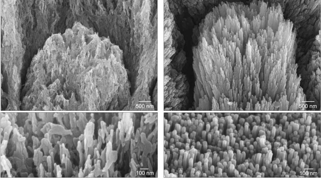 British researchers create gel that can repair tooth enamel