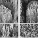 British researchers create gel that can repair tooth enamel