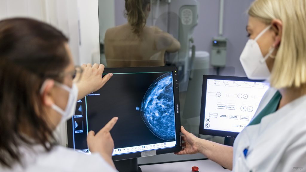Why are more young women dying from breast cancer?