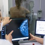 Why are more young women dying from breast cancer?