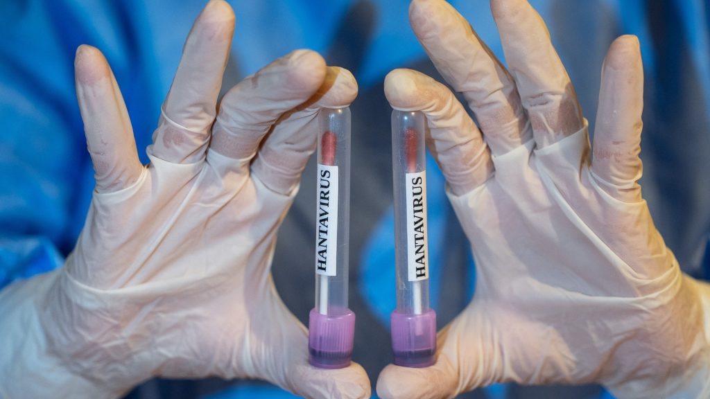 Hantavirus is not the new COVID-19, despite what social media says