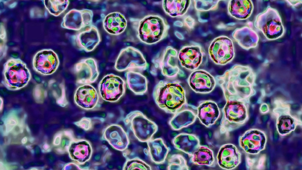 40-year-old Pennsylvania woman dies from measles complications
