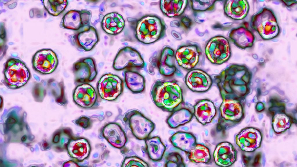Pennsylvania reports sixth measles-related death